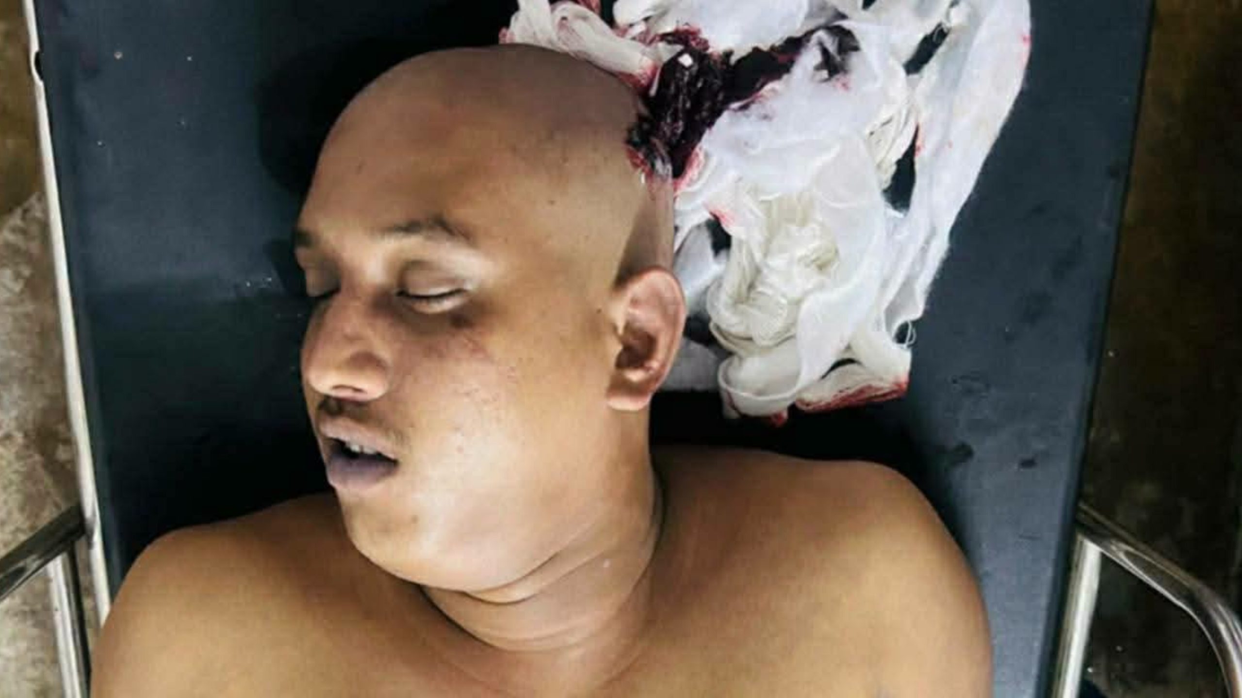 বাসন থানার ১৮ নম্বর ওয়ার্ডে অটোচালকের রহস্যজনক মৃত্যু, সুষ্ঠু তদন্তের দাবি